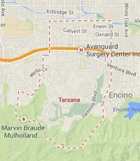 Tarzana